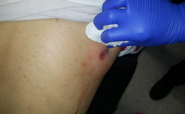 Yunan güvenlik güçleri mültecilere ateş açtı: 1 ölü, 5 yaralı