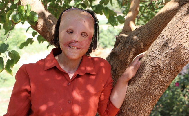 Akdeniz Üniversitesi Layla&#039;nın yüzünü güldürdü