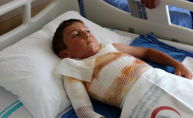 Gömleğindeki ipi yakmak isterken kendini yaktı